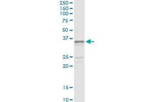 Immunoprecipitation of SGCG transfected lysate using mouse monoclonal anti-SGCG and Protein A Magnetic Bead (SGCG (人) IP-WB Antibody Pair)