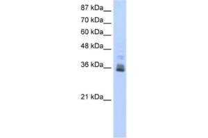 Western Blotting (WB) image for anti-Zinc Finger Protein 197 (ZNF197) antibody (ABIN2461810) (ZNF197 抗体)