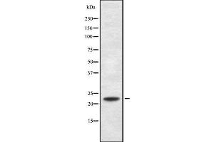 Western blot analysis of RANBP1 using MCF7 whole cell lysates (RANBP1 抗体  (N-Term))