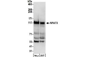 Western Blotting (WB) image for anti-Nuclear Factor of Activated T-Cells, Cytoplasmic, Calcineurin-Dependent 4 (NFATC4) (AA 852-902) antibody (ABIN7453742)