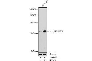 Western blot analysis of extracts of NIH/3T3 cells, using Phospho-eIF4E-S209 antibody (ABIN6135213, ABIN6136062, ABIN6136063 and ABIN6225650) at 1:500 dilution. (EIF4E 抗体  (pSer209))
