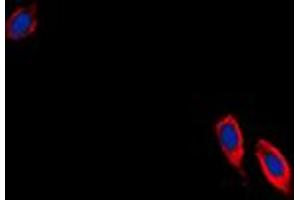 Immunofluorescent analysis of Ephrin B3 staining in NIH3T3 cells. (Ephrin B3 抗体  (C-Term))