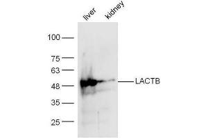 Mouse liver/kidney lysates probed with Anti-LACTB Polyclonal Antibody  at 1:5000 90min in 37˚C. (LACTB 抗体  (AA 101-200))