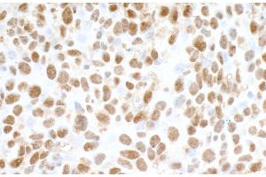 Immunohistochemistry (IHC) image for anti-Fused in Sarcoma (FUS) (AA 1-50) antibody (ABIN7454040) (Recombinant FUS 抗体  (AA 1-50))