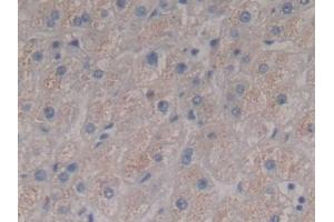 Immunohistochemistry (IHC) image for anti-Fibrinogen alpha Chain (FGA) (AA 124-214) antibody (ABIN7433189)