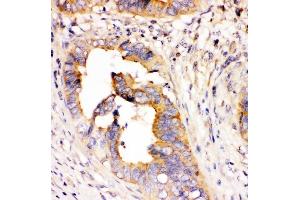 IHC analysis of DHFR using anti-DHFR antibody (ABIN6719418).