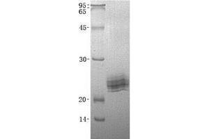 Validation with Western Blot (LAIR2 Protein (Transcript Variant 1) (His tag))