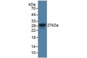 Detection of Recombinant JAM1, Human using Polyclonal Antibody to Junctional Adhesion Molecule 1 (JAM1) (F11R 抗体  (AA 64-249))