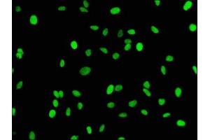 Immunofluorescence staining of Hela cells with ABIN7127300 at 1:43,counter-stained with DAPI. (Recombinant HIST1H3A 抗体  (H3K18me))