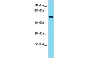 Western Blotting (WB) image for anti-Coronin, Actin Binding Protein, 2B (CORO2B) (N-Term) antibody (ABIN2784790)