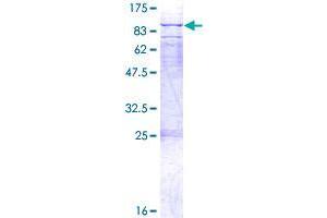 WBSCR17 Protein (AA 1-598) (GST tag)