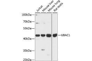 Western blot analysis of extracts of various cell lines, using UB antibody (ABIN6133006, ABIN6149772, ABIN6149773 and ABIN6216923) at 1:3000 dilution.