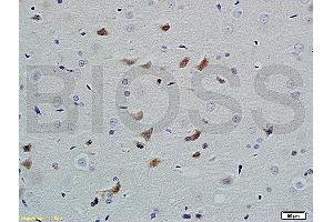 Formalin-fixed and paraffin embedded rat brain labeled with Anti PHAP1 Polyclonal Antibody, Unconjugated (ABIN762176) at 1:200 followed by conjugation to the secondary antibody and DAB staining (PHAP 抗体  (AA 41-140))