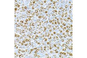 Immunohistochemistry of paraffin-embedded mouse stomach using DLK1 antibody. (DLK1 抗体  (AA 83-383))