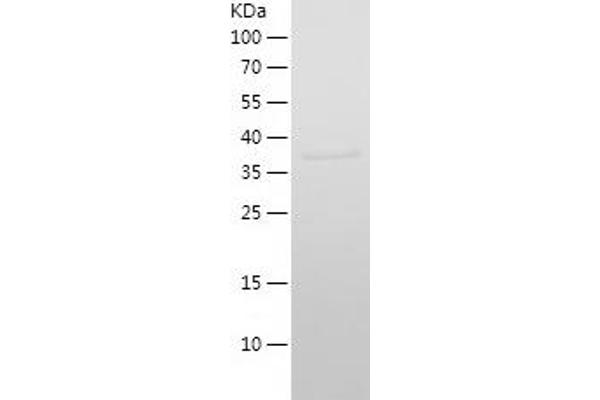 IFITM2 Protein (AA 1-132) (His-IF2DI Tag)