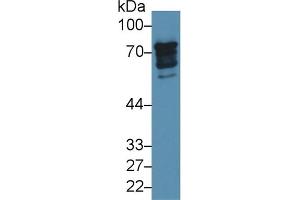 Detection of EPN1 in Human 293T cell lysate using Polyclonal Antibody to Epsin 1 (EPN1) (Epsin 1 抗体  (AA 279-437))