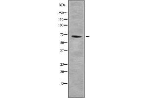 Western blot analysis NBPF6 using Jurkat whole cell lysates (NBPF6 抗体  (C-Term))