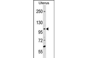 SCUBE3 Antibody (Center) (ABIN1538453 and ABIN2838104) western blot analysis in Uterus tissue lysates (35 μg/lane). (SCUBE3 抗体  (AA 480-509))