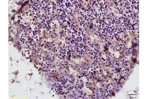 Formalin-fixed and paraffin embedded mouse embryo labeled with Anti ADA/Adenosine deaminase Polyclonal Antibody, Unconjugated (ABIN719471) at 1:200 followed by conjugation to the secondary antibody and DAB staining (ADA 抗体  (AA 65-170))