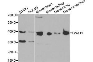 Western blot analysis of extracts of various cell lines, using GNA11 antibody. (GNA11 抗体)