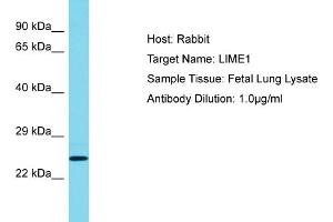 Host: Rabbit Target Name: LIME1 Sample Tissue: Human Fetal Lung Antibody Dilution: 1ug/ml (LIME 抗体  (C-Term))