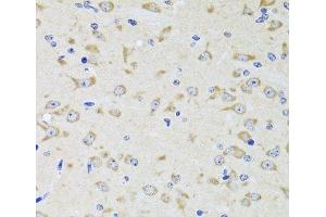 Immunohistochemistry of paraffin-embedded Rat brain using YWHAZ Polyclonal Antibody at dilution of 1:100 (40x lens). (14-3-3 zeta 抗体)