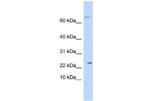 LOC441956 antibody used at 1 ug/ml to detect target protein. (LOC441956 抗体  (N-Term))