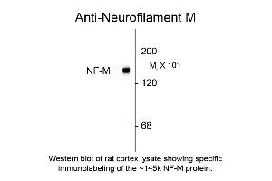 Western blot of Anti-Neurofilament M (Chicken) Antibody - 212-901-D84 Western Blot of Chicken anti-Neurofilament M antibody. (NEFM 抗体  (C-Term))
