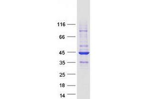 Western Blotting (WB) image for Ras Association (RalGDS/AF-6) Domain Family Member 2 (RASSF2) (Transcript Variant 2) protein (Myc-DYKDDDDK Tag) (ABIN2730561)