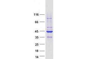 Validation with Western Blot (RASSF2 Protein (Transcript Variant 2) (Myc-DYKDDDDK Tag))