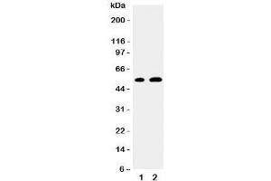 Western blot testing of EGR2 antibody and Lane 1:  mouse NIH3T3;  2: human MCF-7 cell lysate. (EGR2 抗体  (N-Term))