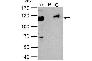 IP Image KAP1 antibody immunoprecipitates KAP1 protein in IP experiments.