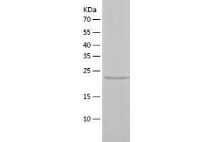 Western Blotting (WB) image for Sperm Associated Antigen 7 (SPAG7) (AA 1-227) protein (His tag) (ABIN7284600) (SPAG7 Protein (AA 1-227) (His tag))