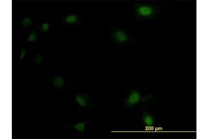 Immunofluorescence of monoclonal antibody to UBE2M on HeLa cell. (UBE2M 抗体  (AA 1-183))