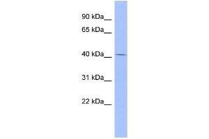 WB Suggested Anti-CFP Antibody Titration: 0. (CFP 抗体  (Middle Region))