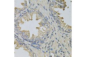 Immunohistochemistry of paraffin-embedded human prostate using LITAF Antibody. (LITAF 抗体  (AA 1-161))