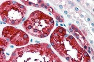 Immunohistochemistry (IHC) image for anti-Ferritin, Heavy Polypeptide 1 (FTH1) (C-Term) antibody (ABIN334401)