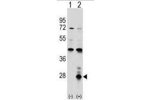 Western blot analysis of AZU1 (arrow) using rabbit polyclonal AZU1 Antibody (Center) . (Azurocidin 抗体  (Middle Region))