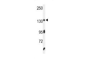 Western blot analysis of ZO1 Antibody in K562 cell line lysates (35ug/lane) (TJP1 抗体  (C-Term))