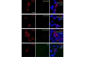 Binding of serum samples #1, #3, #27, healthy control (HC) serum and a commercial antibody against the according Kv channels to transfected HEK293 cells.