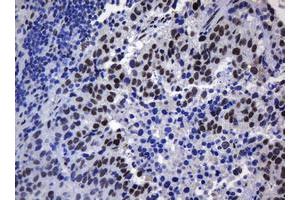 Image no. 6 for anti-Zinc Finger and SCAN Domain Containing 18 (ZSCAN18) antibody (ABIN1501861)