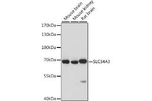 Western blot analysis of extracts of various cell lines, using SLC34 antibody (ABIN7270451) at 1:1000 dilution. (SLC34A3 抗体  (AA 210-320))
