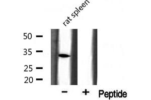 Western blot analysis of extracts from rat spleen, using BST1 antibody. (BST1 抗体  (Internal Region))