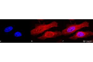 Immunocytochemistry/Immunofluorescence analysis using Rabbit Anti-Alpha B Crystallin Polyclonal Antibody . (CRYAB 抗体  (APC))
