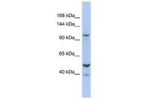 DDX58 antibody used at 1 ug/ml to detect target protein. (DDX58 抗体)