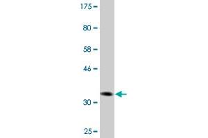 Western Blot detection against Immunogen (36. (DVL3 抗体  (AA 1-100))