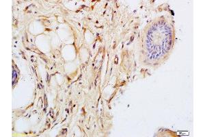 Immunohistochemistry (Paraffin-embedded Sections) (IHC (p)) image for anti-pan Keratin (panKRT) antibody (ABIN734498)