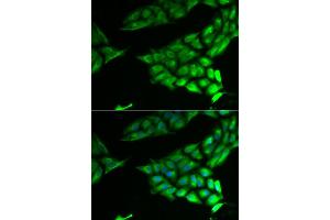Immunofluorescence analysis of U2OS cell using PSAT1 antibody. (PSAT1 抗体)