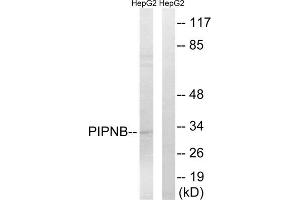 Western blot analysis of extracts from HepG2 cells, using PITPNB antibody. (PITPNB 抗体  (Internal Region))