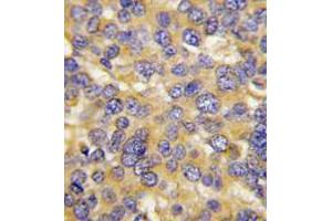 Image no. 3 for anti-DKK3 (N-Term) antibody (ABIN357071) (DKK3 抗体  (N-Term))